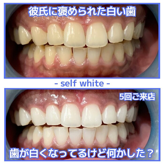 画像687