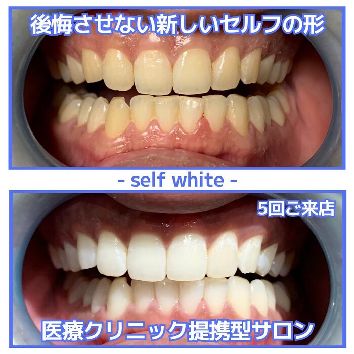 画像728
