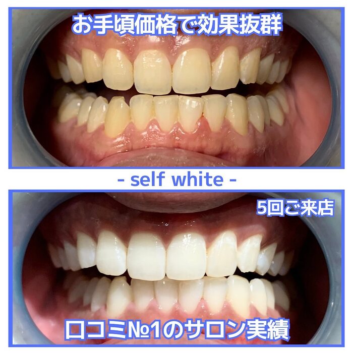 画像729
