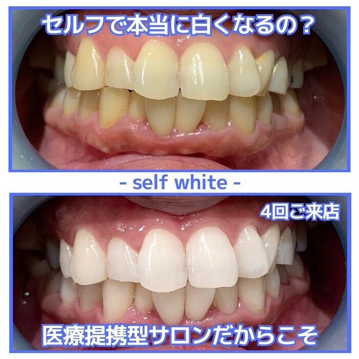 画像740