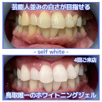 画像741
