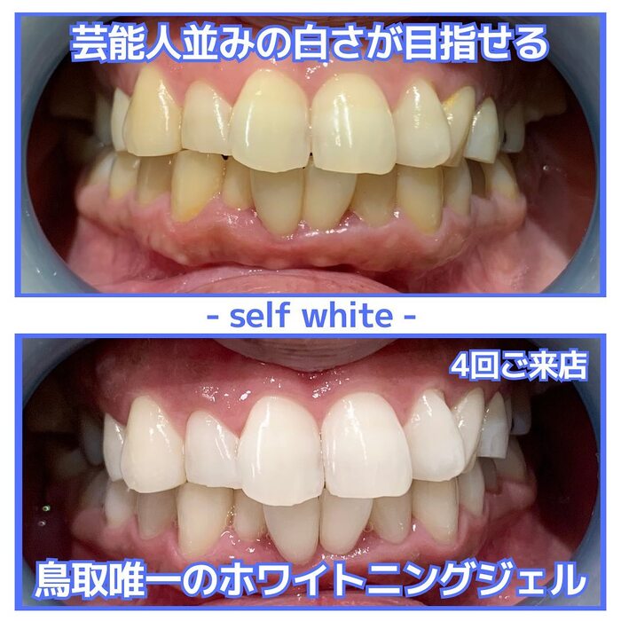 画像741