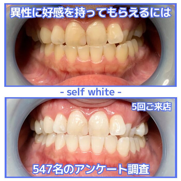 画像832