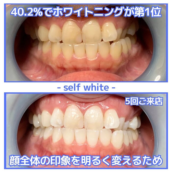 画像833
