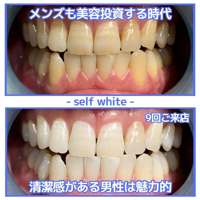 画像853