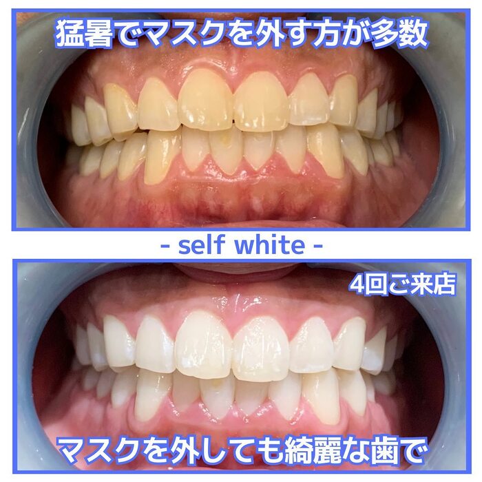 画像881